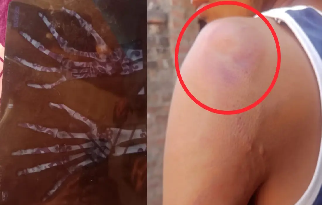 Brutally Beaten up, Mainpuri News